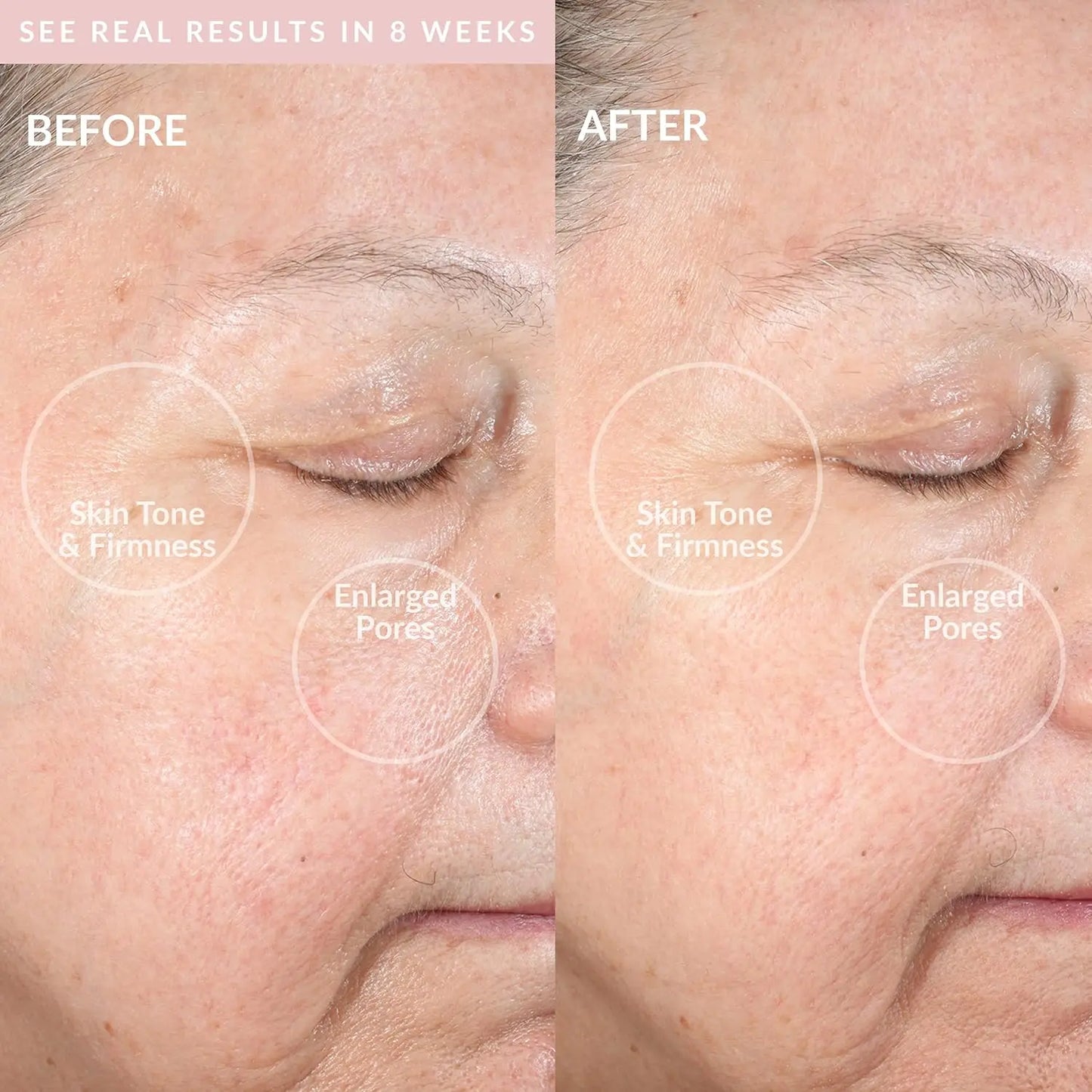 Facial Cleansing Device Pro Grade Deep Pore Sonic Cleanse